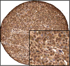 IHC