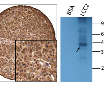 Anti-BQ antibody