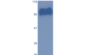 Granulin-Epithelin Precursor (GEP)