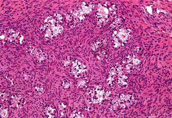 Aminoxy Acid-Based Molecules as Anti-Cancer Stem Cell Agents