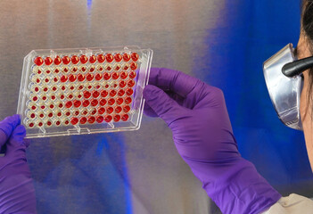 A Novel, Highly Sensitive and Specific Diagnostic Assay for COVID-19