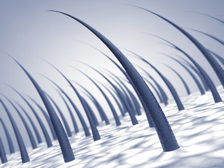 Bioengineered Hair Follicles