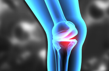 In Vitro Generation of an Osteochondral Interface