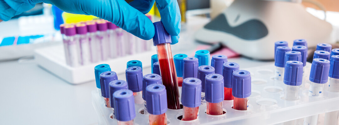 An antibody for predicting Tamoxifen response in breast cancer patients