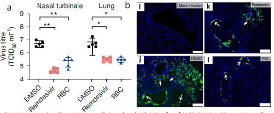 Hamsters (n = 5) were intranasally inoculated with 104 p.f.u. of SARS-CoV-2 and intraperitoneally given either DMSO (vehicle control), RBC (150 mg/kg) or remdesivir (15 mg/kg) for four consecutive days. (a) Virus titres; (b) Viral N protein expression in lung tissue sections 1